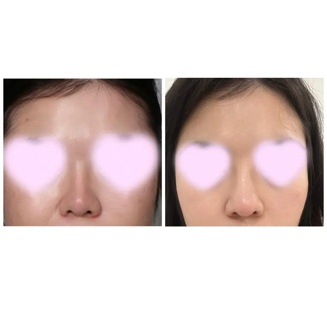 Another Plastic Surgery — 2