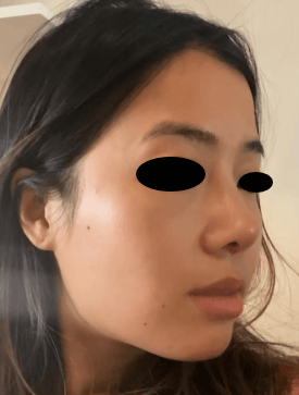 BRAUN Plastic Surgery — 2