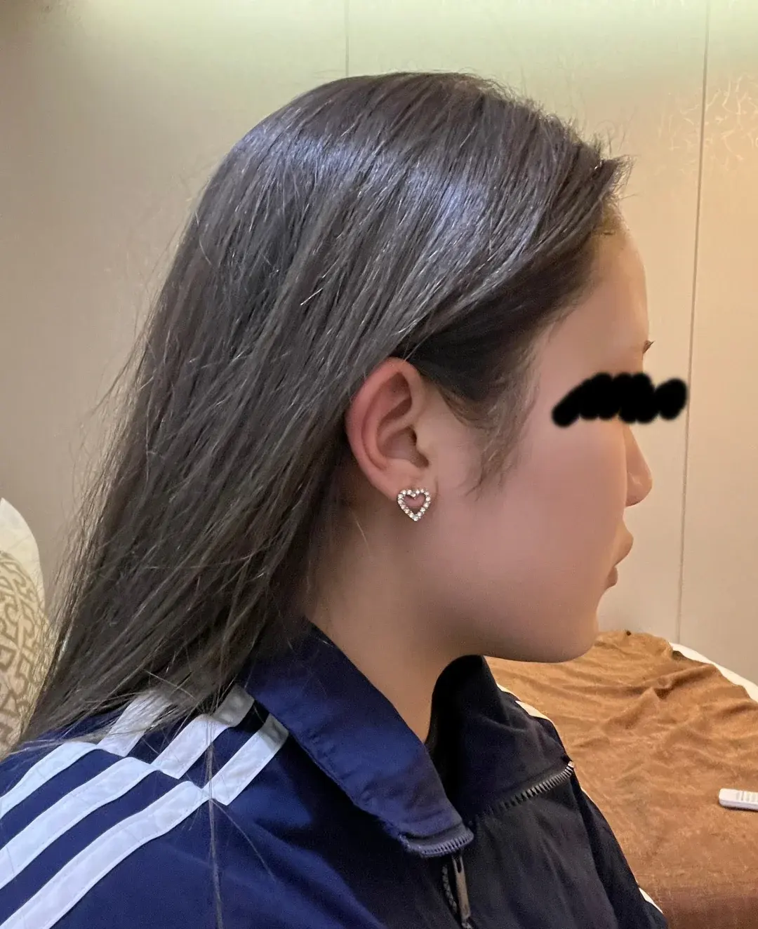 BT Plastic Surgery — 1