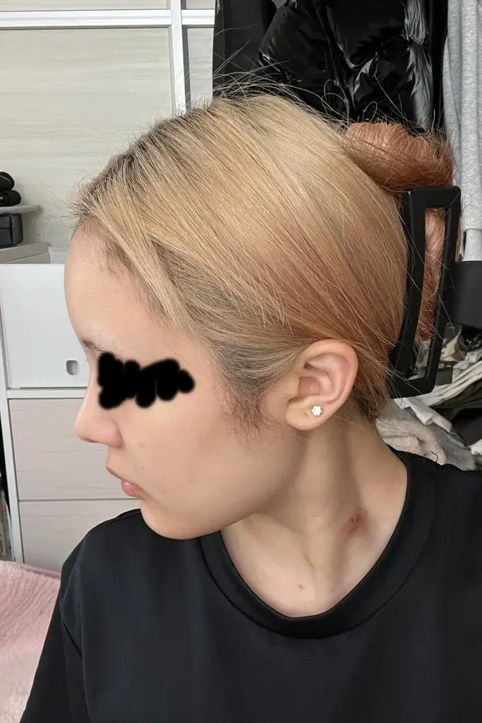 BT Plastic Surgery — 2