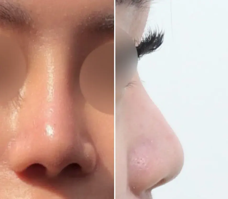 NOTE Plastic Surgery — 1