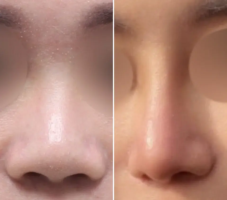 NOTE Plastic Surgery — 2
